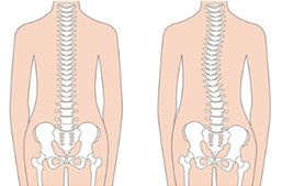 カイロプラクティック＆骨格矯正